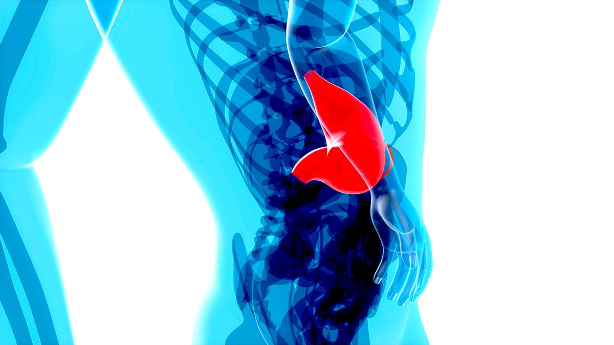 Hepatitis A